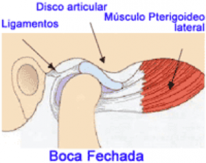 MANDÍBULA ESTALANDO (ESTRALANDO) - Disfunção da articulação  temporomandibular (ATM/DTM) 